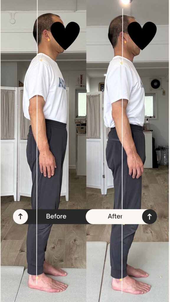 Before after 2