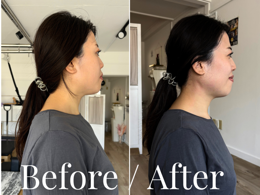 ビフォーアフター