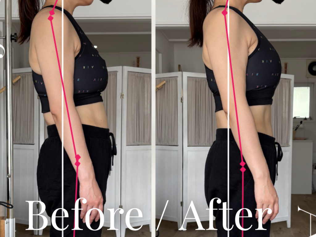 ビフォーアフター